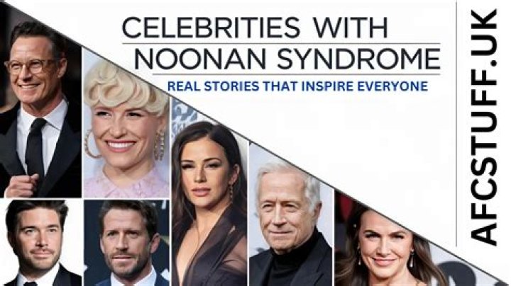 Noonan Syndrome: Inspiring Celebrities & Their Stories